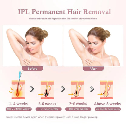 REDFMG IPL Laser Hair Removal for Women - Pixel World Store